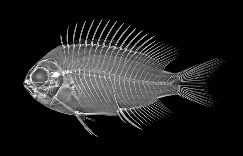 X-ray of Pomacentrus vatosoa showcasing its unique features