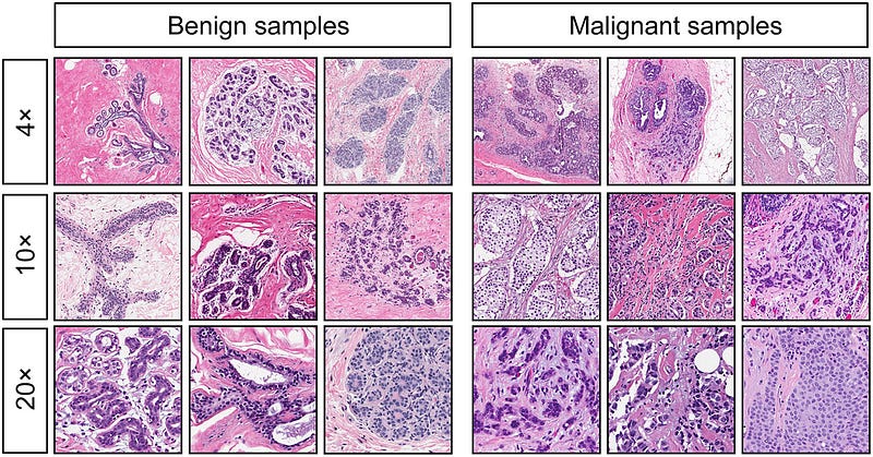 Pathologists Analyzing Cancerous Samples