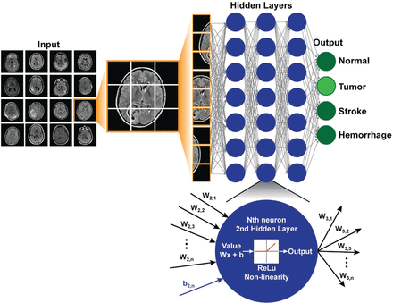 Deep Learning in Medicine Example